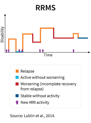 This graphic shows the kinds of disease activity that may occur in RRMS over time.